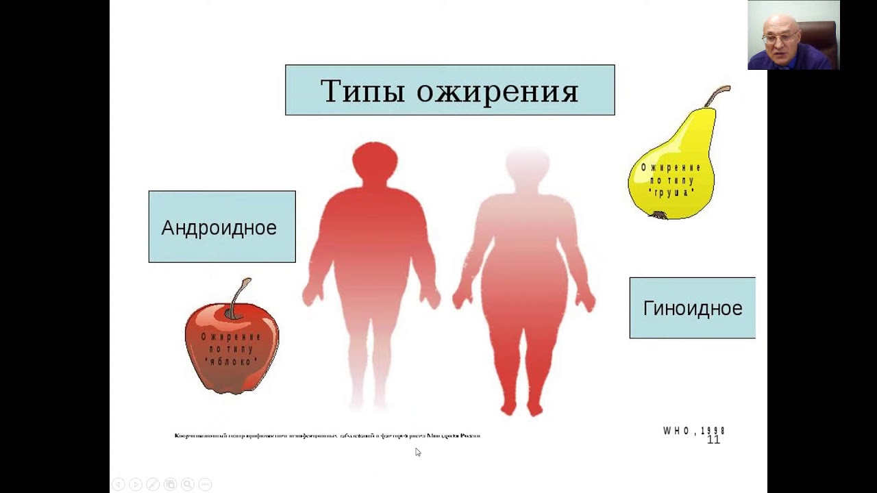 типы ожирения. типы ожирения гиноидное и андроидное. типы ожирения яблоко и груша. абдоминальный и гиноидный тип ожирения. андроидный тип ожирения.