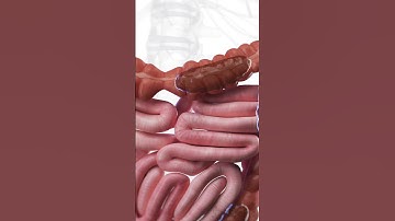 What Constipation Looks Like | 3D Animation