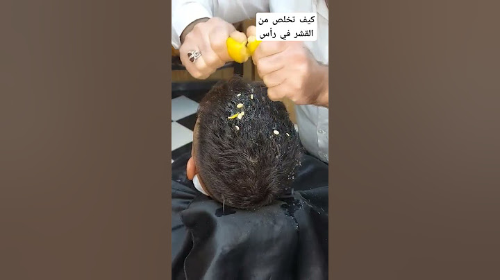 ليمون حل الواحد لخلص من القشره رأس