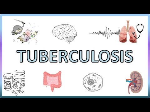 Video: Longtuberculose Bij Volwassenen - Symptomen, Tekenen, Stadia En Vormen Van Pulmonale Tuberculose
