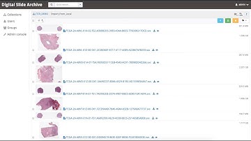 Managing and visualizing data with the Digital Slide Archive