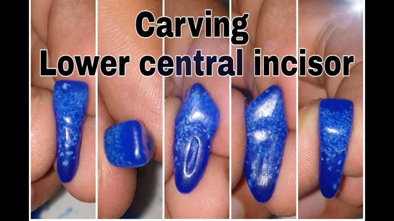Carving lower central incisor (فيديو كامل شامل جميع الخطوات ) YouTube