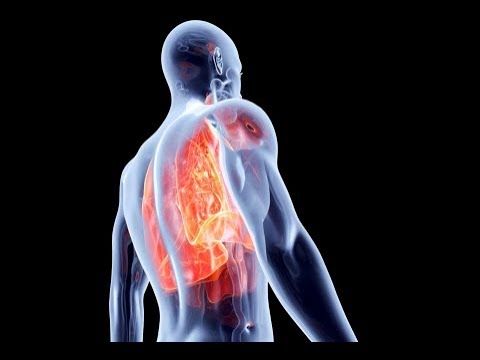 Oxygen Deficiency In Body - Hypoxia Signs And Symptoms