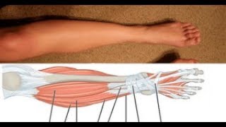 Piernas amish los detener y pies calambres de