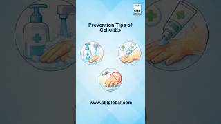 Prevention Tips of Cellulitis