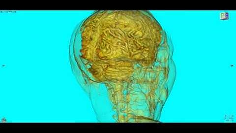OsiriX: render cortical surface and fly-through