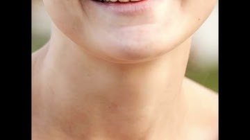 A special thank you to the Uniting Medically Supervised Injection Centre