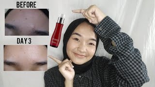 Ini Dia Tips Supaya Kulit Nggak Kusam dan Gampang Menua! | FD Quick Lesson with Pond's Age Miracle