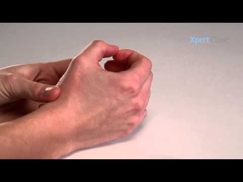 Video: Oefeningen Voor Artritis: 11 Oefeningen Met Instructies