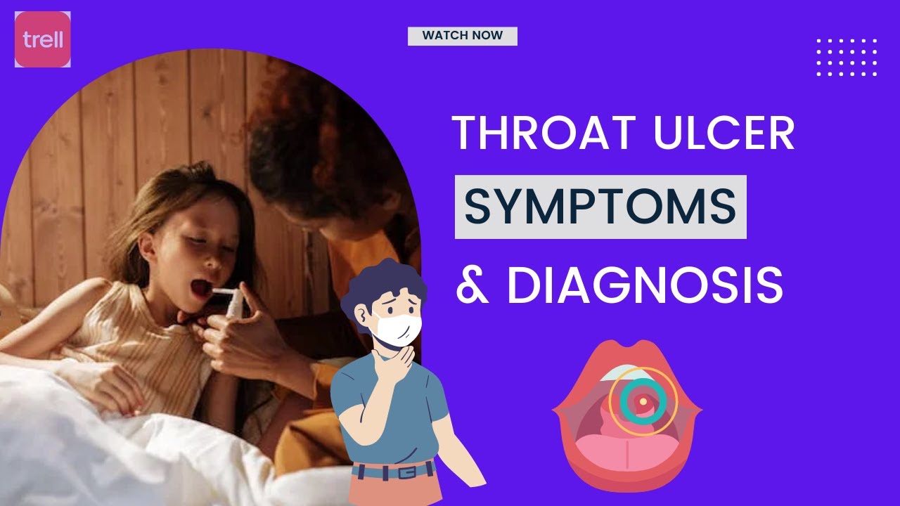 throat-ulcer-symptoms-and-diagnosis-throat-ulcers-health-medicine