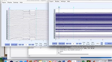 ECE 5332 EEGLAB video 1