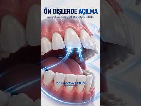 👅 Dilin dinlenme sırasında ön dişlere doğru baskı uygulamasıyla diş yapısını zamanla etkileyebilir.