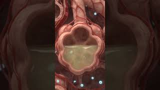 What Happens Inside Your Lungs During Pneumonia 🫁 | Pneumonia Explained