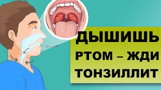 ХРОНИЧЕСКИЙ ТОНЗИЛЛИТ: как заложенность носа усугубляет болезнь