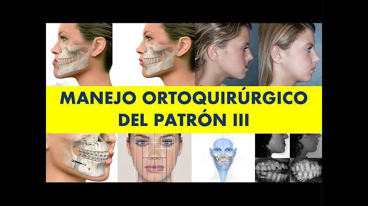 "MANEJO ORTOQUIRRGICO DEL PATRON III" por el Dr. F...
