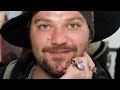 The Truth Revealed About What Happened To Bam Margera