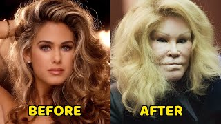 Top 18 Celebrities With Terrible Plastic Surgery