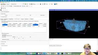 Slicer Bone Imaging Toolbox: ParOsol-FEA
