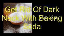 How To Get Rid Of Dark Neck with baking soda, How to get rid of dark neck with baking soda, Home Remedies For Dark Neck - Lemon Juice, How To Get Rid of Dark Underarms With Baking Soda and Lemon, Dark Neck Home Remedy _ Quick Lightening & Whitening DIY _ SuperWowStyle Prachi
