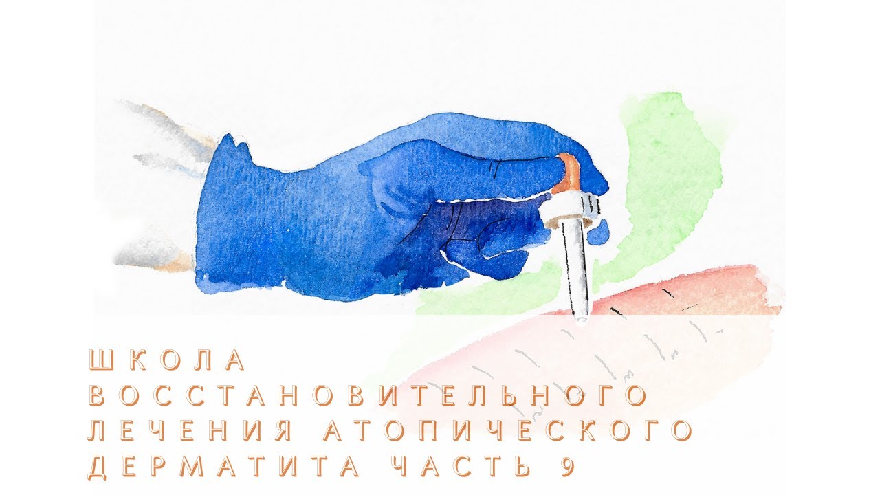 Часть 9. Атопический дерматит как нейродермит. Клинические рекомендации ...