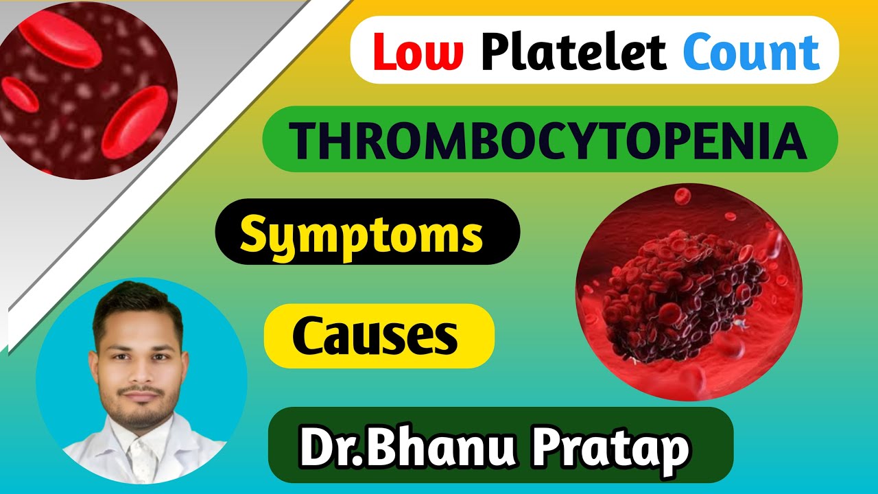 "Homeopathy Treatment For Low Platelets! Natural Ways To Boost Platelet Count" Thrombocytopenia!