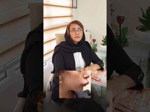 تزریق خوشگل ترین ژل های لب فیلر فیلر لب ژل لب تزریق زیبایی مدلینگ کلیپ طنز طنز فان