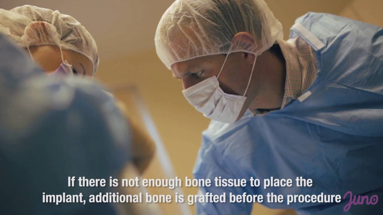 Dental Implant Procedure at Dental Art Implant Clinic YouTube