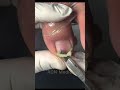 Satisfying Toenail Grooming | Gentle Foot Care Routine #fypシ #cleannails #RelaxingCare #fypシ