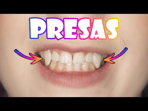 2 FORMAS de Fazer PRESAS para o seu COSPLAY - Dente Falso