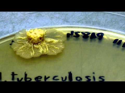 World Tuberculosis Day - combined