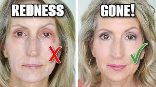 How To Cover Redness, Puffiness, Dark Circles, & Swelling with Makeup | Over 50 screenshot 4