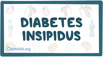 Wie entsteht Diabetes insipidus?