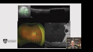 Macular Milestones 2026