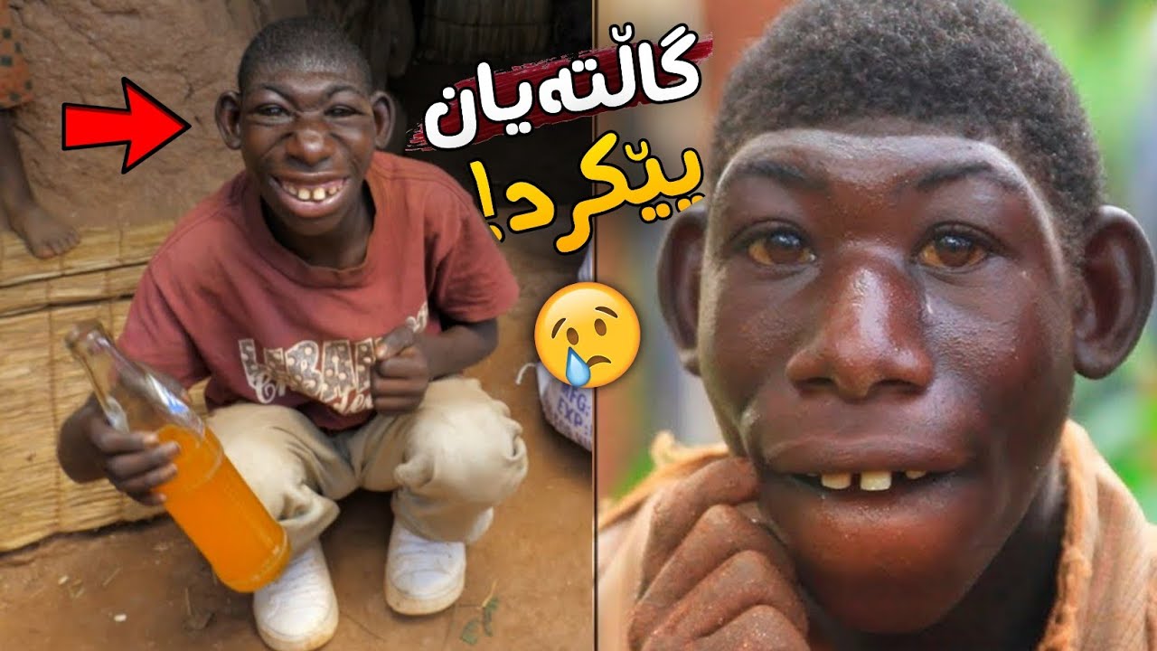 پێیان دەگوت بە مەیمون دەچیت!! چیرۆکی گەنجێک دڵ دەهەژێنێت ..!!