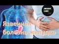 Язвенная болезнь желудка