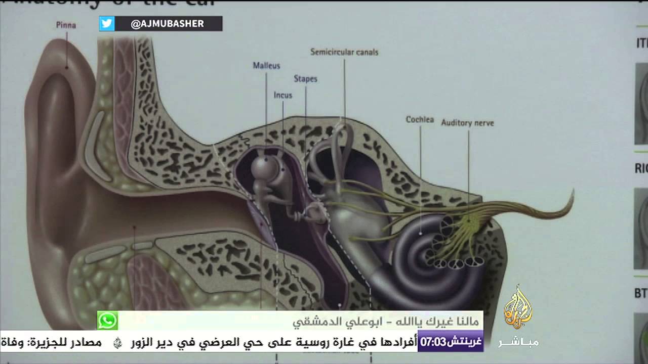 هل زراعة القوقعة السمعية تفيد ام تضر