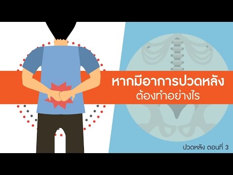 พบอาจารย์หมอกระดูกธรรมศาสตร์ ปวดหลัง ตอนที่ 3: ปวดหลังต้องทำอย่างไร