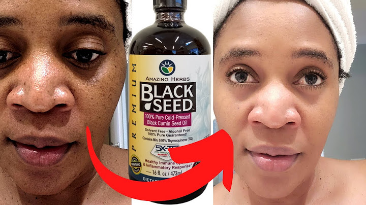 Black seed oil acne before and after