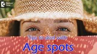 Liver spots on skin | Tips to deal with Age spots  - Dr. Rasya Dixit | Doctors