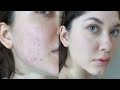 Макияж для проблемной кожи | Тест Mac Mineralize Skinfinish Natural | Как скрыть прыщи и постакне