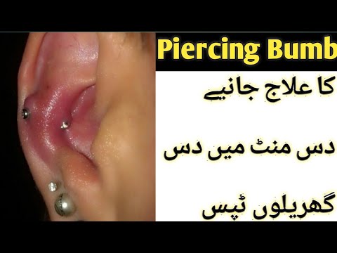 वीडियो: संक्रमित होंठ छिदवाने के 3 आसान तरीके