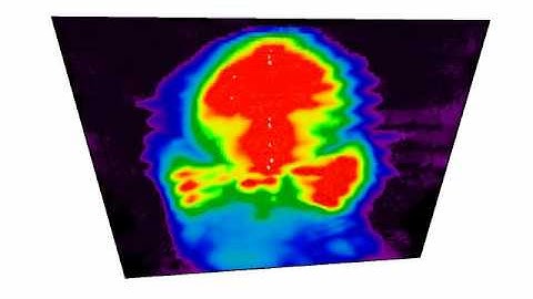 Raycasted MIP on the PET from a Monkey Brain