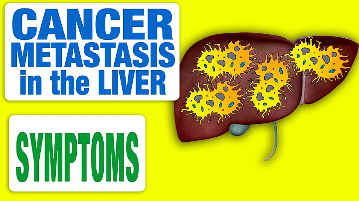 Cancer Metastasis in the Liver - All Symptoms - DayDayNews