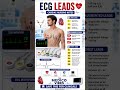 ❤️ ECG leads samajhna ab easy 😍