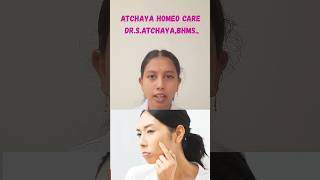 IRON DEFICIENCY#homeopathy #irondeficiency #HairFall #atchayahomeocare #youtubeshorts #womenshealth