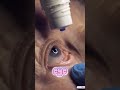She Shared Mascara…  Nearly Cost Her an Eye