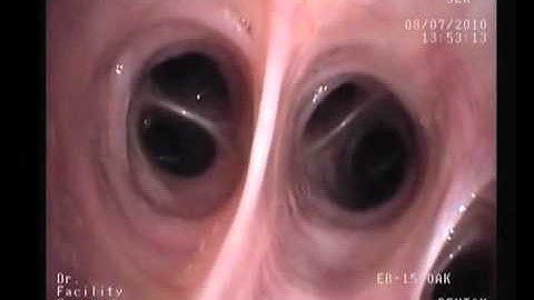 Segmental anatomy.mov