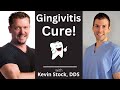 Gingivitis cure cavity cure 7 steps from a dentist kevin stock dds