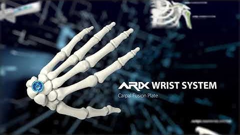 [ARIX OS] Orthopedic Product Introduction