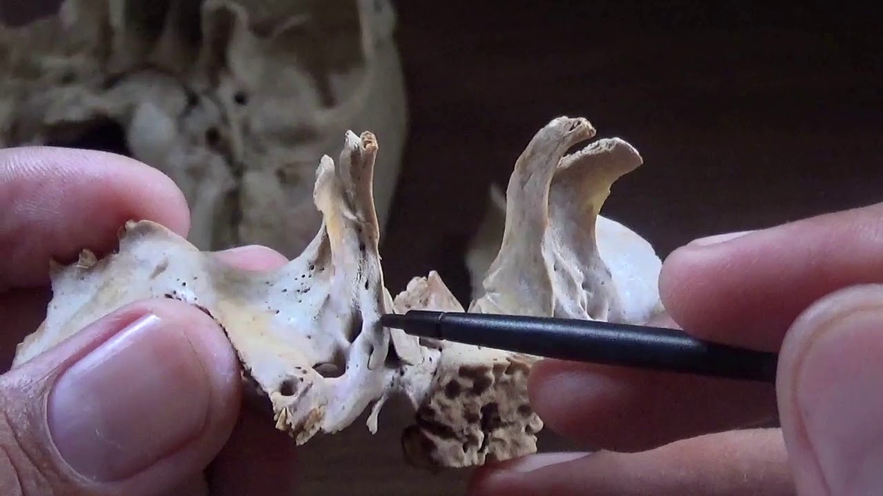 NORMA BASALIS - PART- 2/3